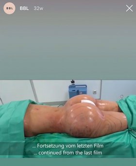 Kann man machen. Screenshot: Instagram