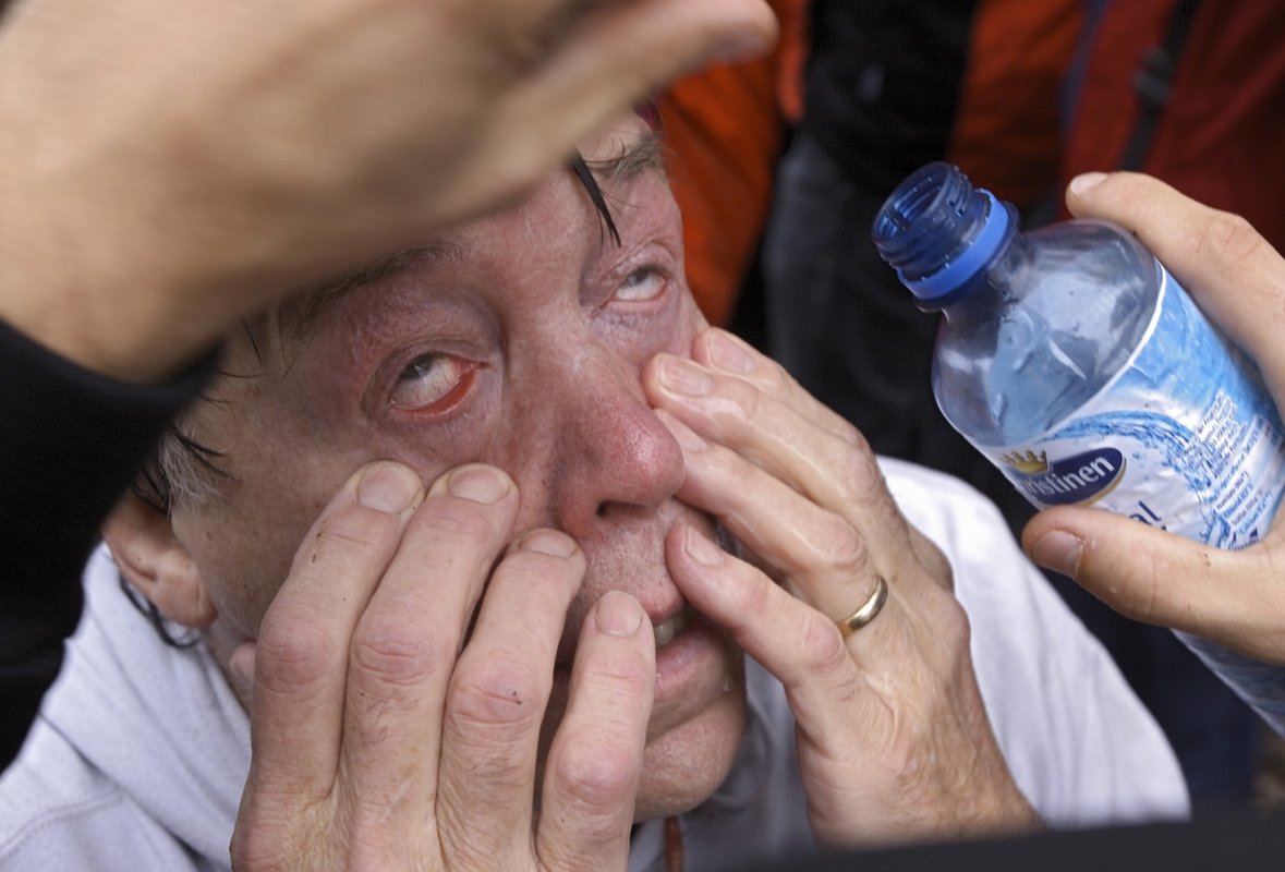 Die unabhängigen Demosanitäter zählen allein 320 Verletzte durch Pfefferspray. Foto: Joachim E. Röttgers