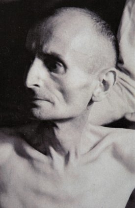 Ein Patient im Militärspital in Herisau, Appenzell Ausserrhoden (Schweiz), wo ehemalige KZ-Häftlinge von der Insel Mainau 1945 auch behandelt wurden. Foto: Bildarchiv Urs Oskar Keller Ein Patient im Militärspital in Herisau, Appenzell Ausserrhoden (Schweiz), wo ehemalige KZ-Häftlinge von der Insel Mainau 1945 auch behandelt wurden. Foto: Bildarchiv Urs Oskar Keller