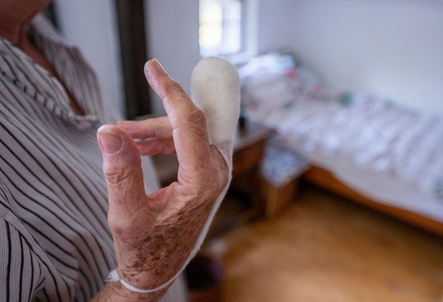 Die abgebissene Fingerspitze, der Tatort. Foto: Jens Volle