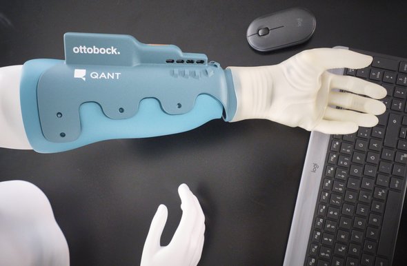 Diese Prothese misst mit einem Magnetfeldsensor Nervensignale und lässt sich dadurch steuern. Diese Prothese misst mit einem Magnetfeldsensor Nervensignale und lässt sich dadurch steuern.