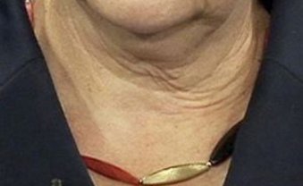 Hätte, hätte, Deutschlandkette