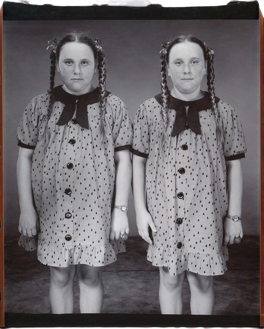 Cayla and Mylee Simmermon, 10 years old, Mylee older by 2 minutes / Cayla und Mylee Simmermon, zehn Jahre alt, Mylee zwei Minuten älter, Twinsburg, Ohio, USA 2001.