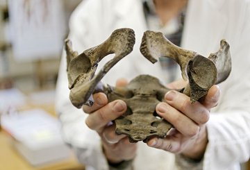 Nicht vollständig verwachsene Beckenknochen.